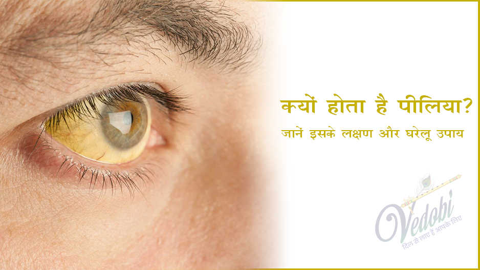 क्यों होता है पीलिया? जानें इसके लक्षण और घरेलू उपाय