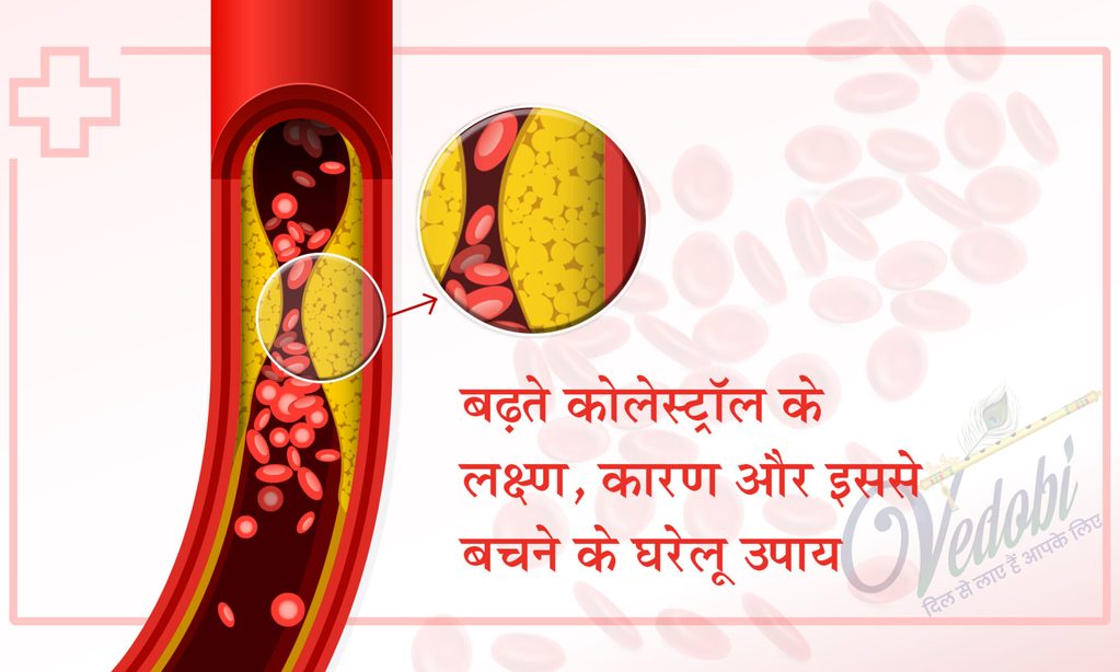 बढ़ते कोलेस्ट्रॉल के लक्षण, कारण और इससे बचने के घरेलू उपाय