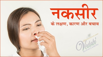 नकसीर के लक्षण, कारण और बचाव