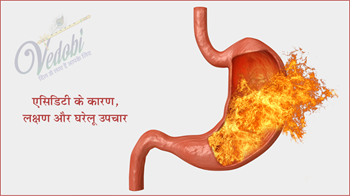 एसिडिटी के कारण, लक्षण और घरेलू उपाय