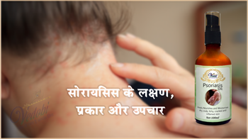 सोरायसिस के लक्षण, प्रकार और उपचार