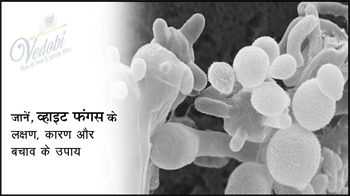 जानें, व्हाइट फंगस के लक्षण, कारण और बचाव के उपाय