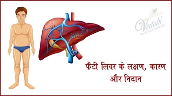 फैटी लिवर के लक्षण, कारण और निदान