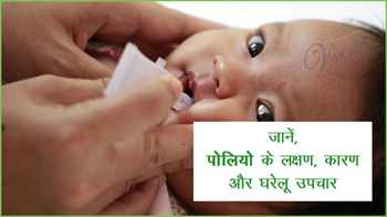 जानें, पोलियो के लक्षण, कारण और घरेलु उपचार