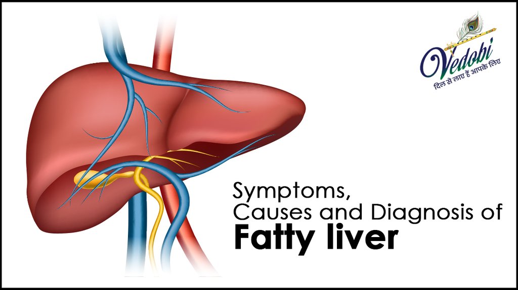 Symptoms, Causes and Diagnosis of Fatty liver