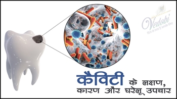 कैविटी के लक्षण, कारण और घरेलू उपचार