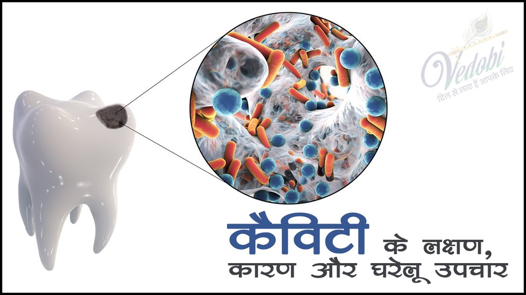 कैविटी के लक्षण, कारण और घरेलू उपचार