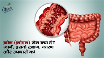 क्रोन (क्रोहन) रोग क्या है? जानें, इसके लक्षण, कारण और उपचार