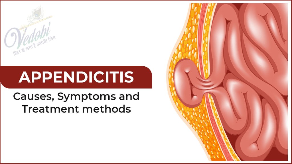 Appendicitis- Causes, Symptoms and Treatment methods