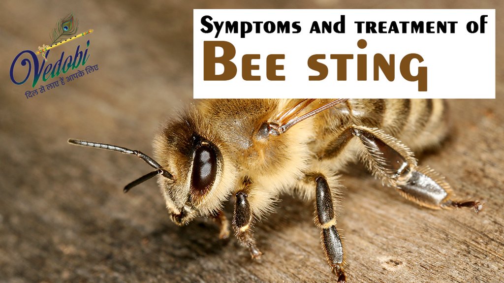 Symptoms and treatment of Bee sting