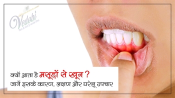 क्यों आता है मसूड़ों से खून? जानें इसके कारण, लक्षण और घरेलू उपचार