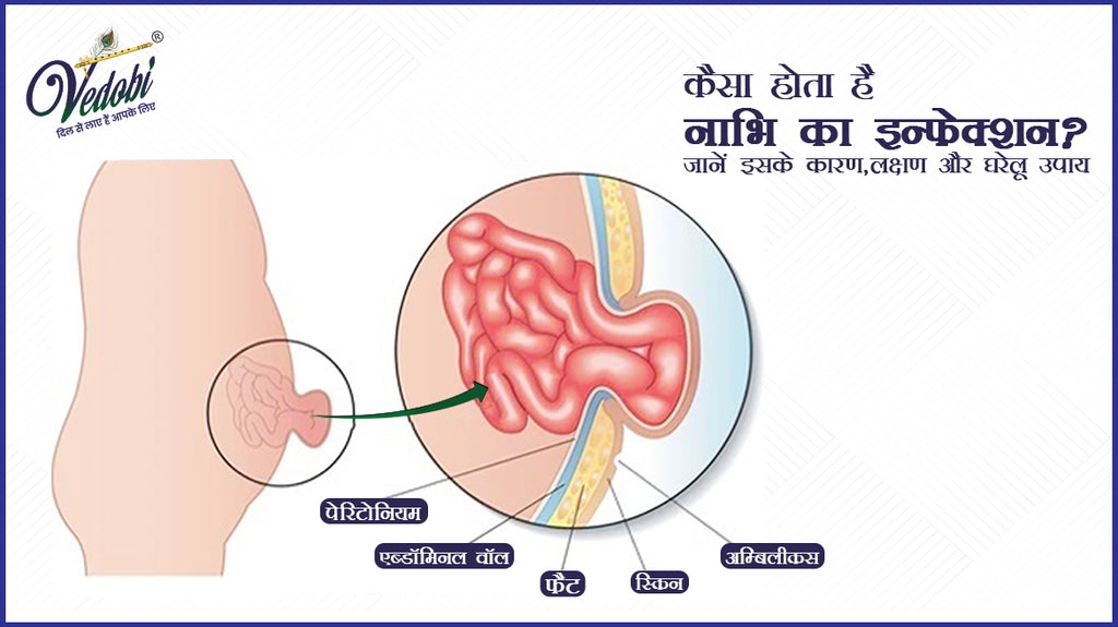 कैसा होता है नाभि का इन्फेक्शन? जानें इसके कारण, लक्षण और घरेलू उपाय