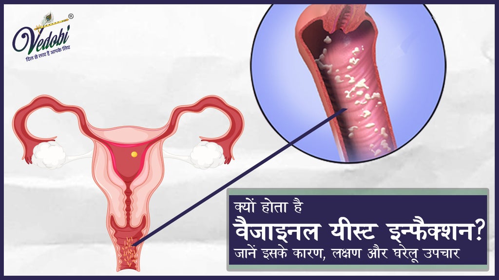 क्यों होता है वैजाइनल यीस्ट इंफेक्शन? जानें इसके कारण, लक्षण और घरेलू उपचार