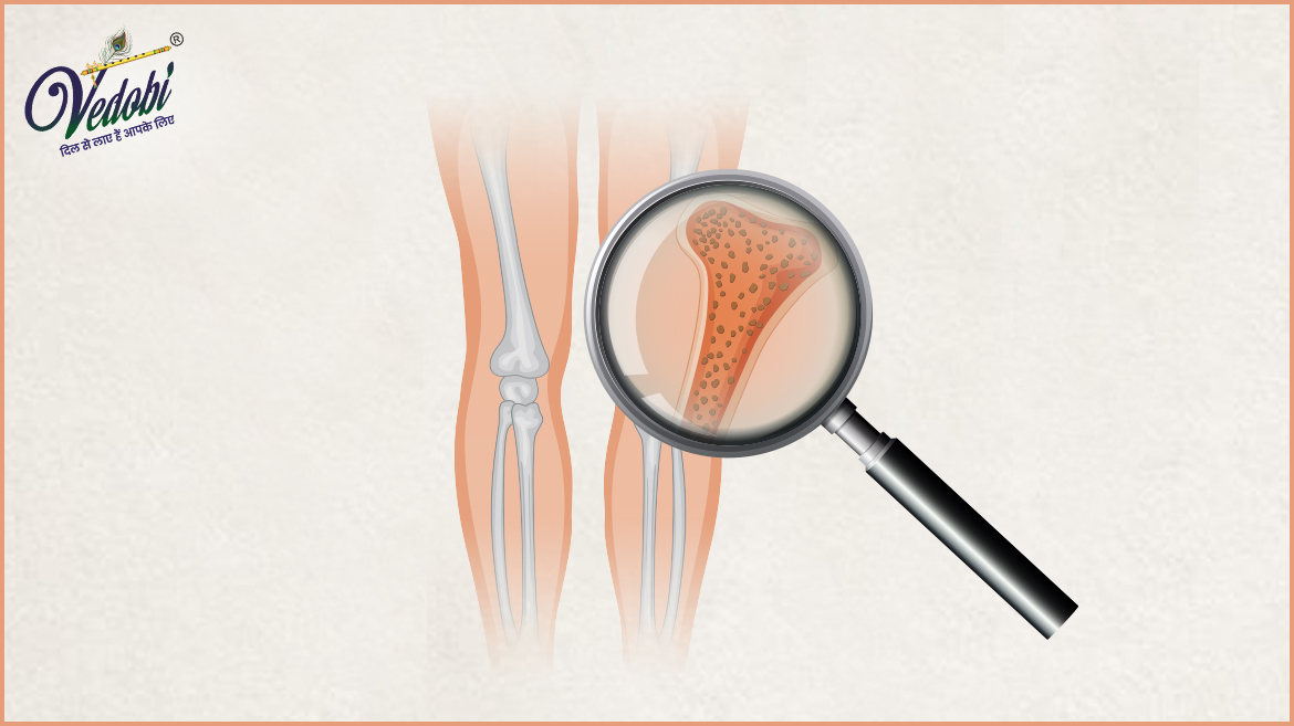 What is Osteopenia? Know its Symptoms, Causes and Treatment methods