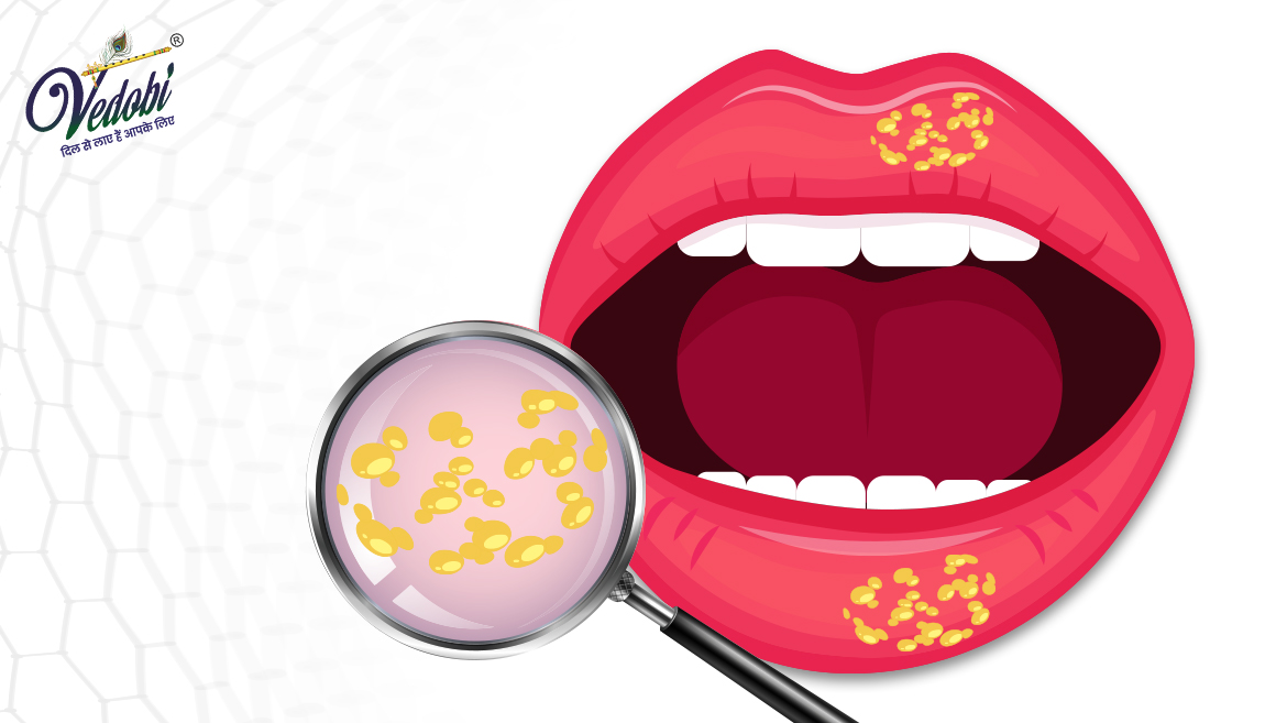 Types, Causes, Symptoms and Treatment methods of Herpes