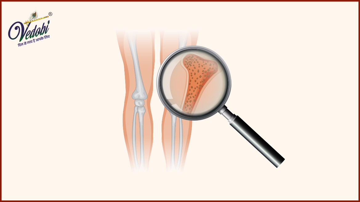 क्या है ऑस्टियोपीनिया? जानें इसके लक्षण, कारण और उपचार