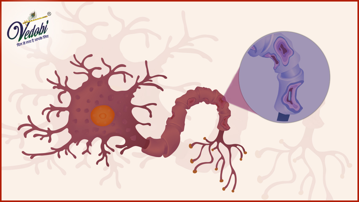 What is Multiple sclerosis (MS)? Know its Types, Symptoms, Causes and Treatment