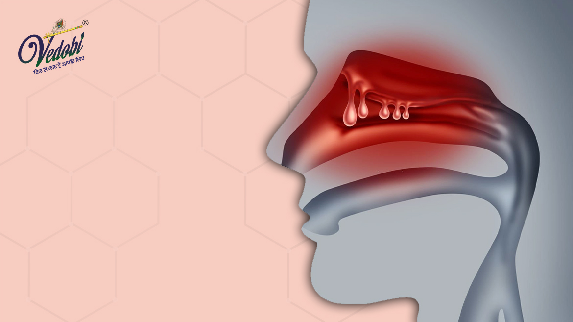 Nasal Polyps: Symptoms, Causes and Treatment