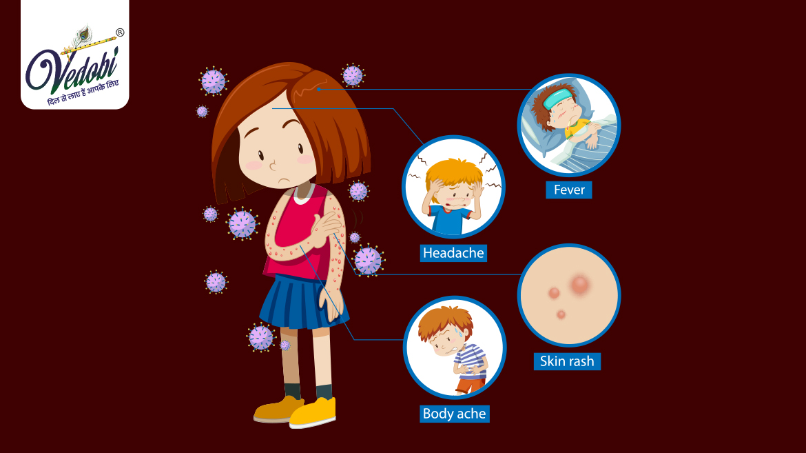 Monkeypox- A Rare Viral Disease