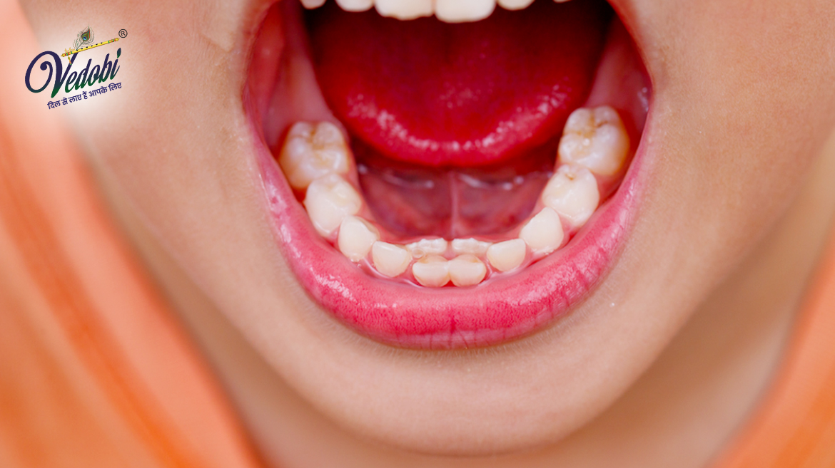 Hyperdontia: Symptoms, Causes, Diagnosis and Treatment