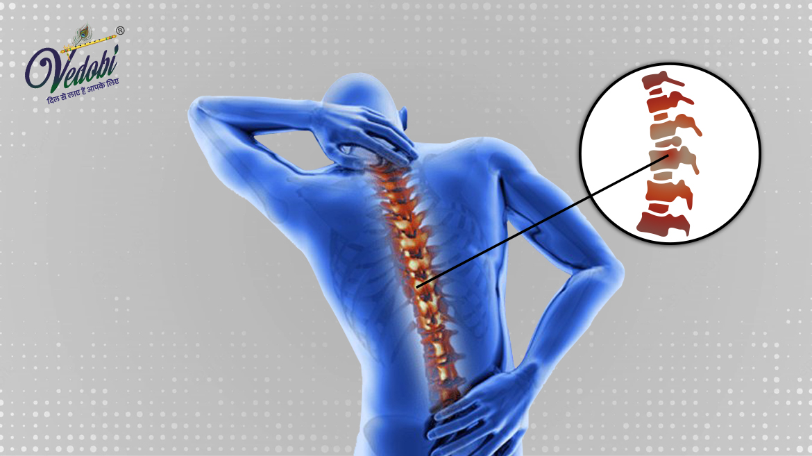 Spondylosis Causes, Symptoms and Treatment