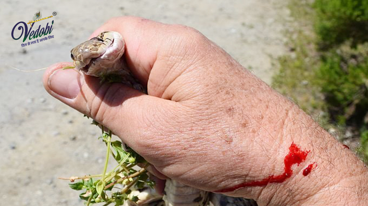 Know what to do in case of a Snake bite?