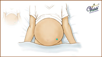 Ascites: What is it? Symptoms, Causes and Treatment
