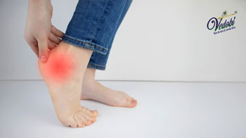 Heel Spurs: Symptoms, Causes and Home Remedies