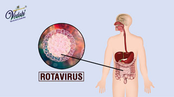 What is Rotavirus? Know its Symptoms, Causes and Treatment