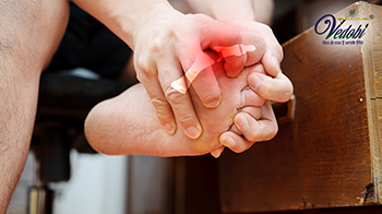 बनियन (पैर की हड्डी बढ़ना) क्या है? जानें, इसके कारण, लक्षण और उपचार