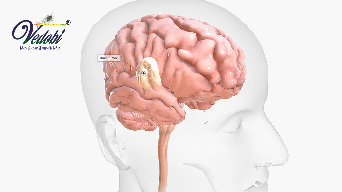 What is Encephalitis: Know its Symptoms, Causes and Treatment