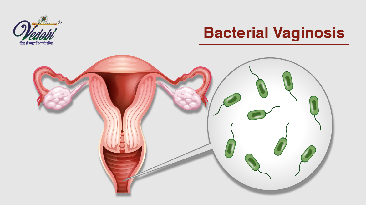 क्या होता है बैक्टीरियल वेजिनोसिस? जानें इसके कारण और लक्षण