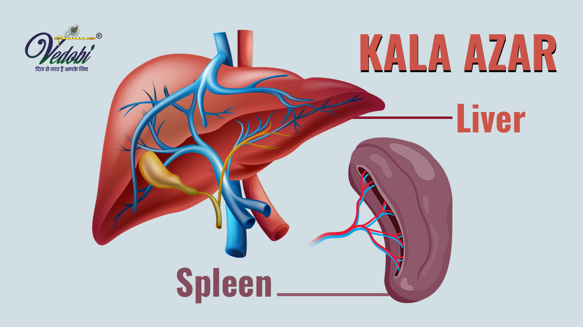 काला अज़ार क्या है? जानें, इसके लक्षण, कारण और बचाव