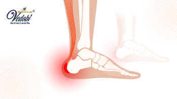 जानें, एड़ी की हड्डी बढ़ने के कारण, लक्षण और घरेलू उपचार