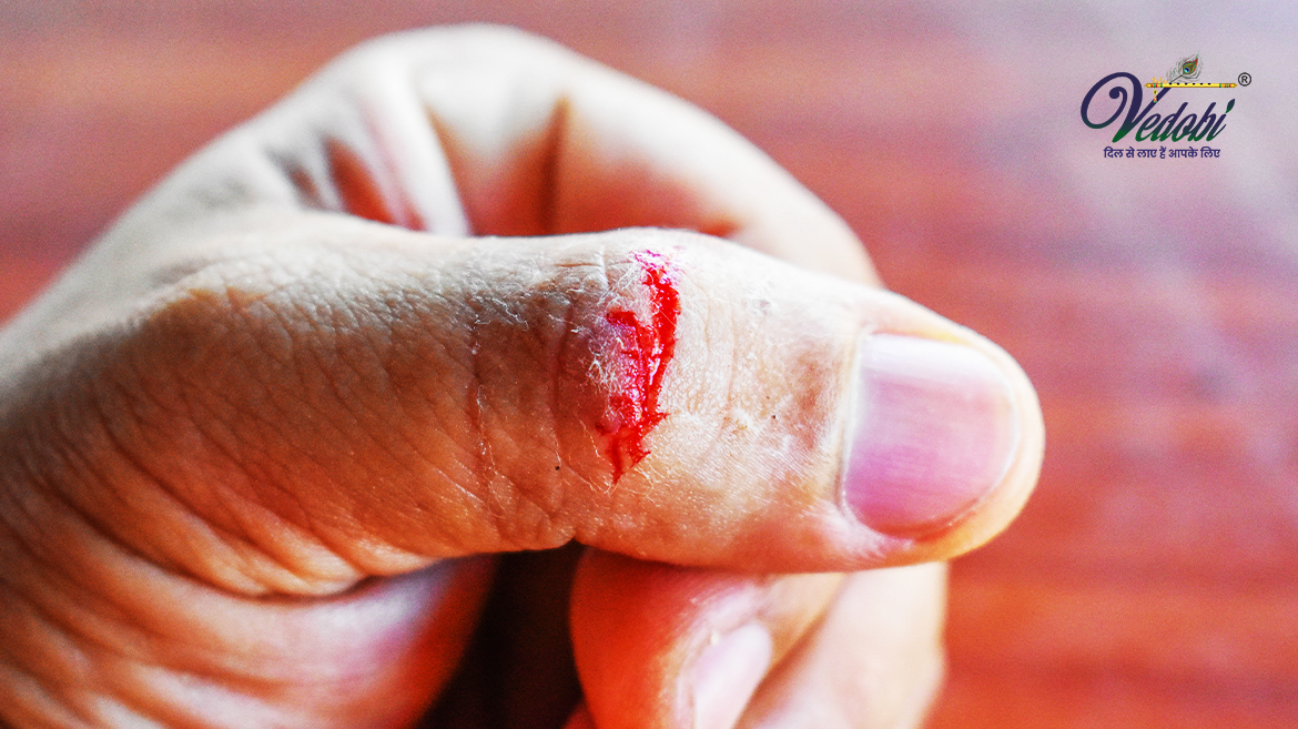 Home remedies for open wounds