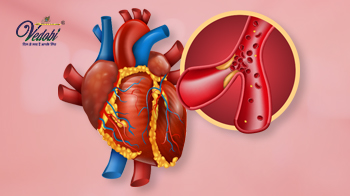 Coronary artery disease- Symptoms, Causes, Treatment & Prevention
