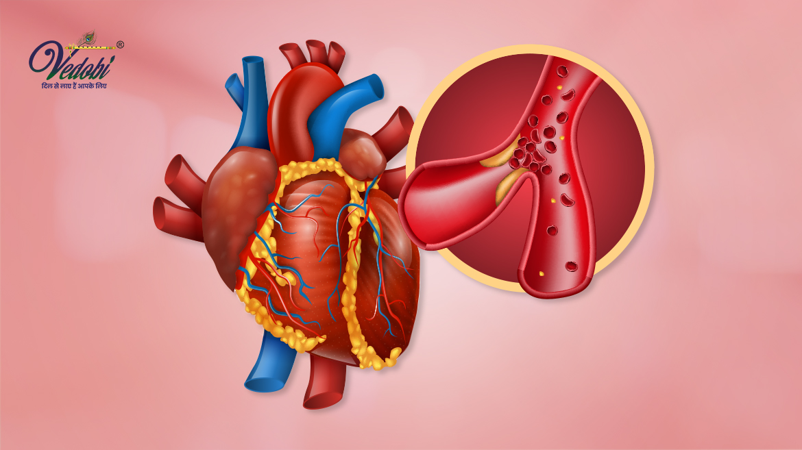 Coronary artery disease- Symptoms, Causes, Treatment & Prevention